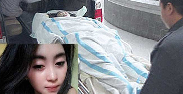 Pemandu Lagu Cantik yang Disiram Air Keras Akhirnya Meninggal